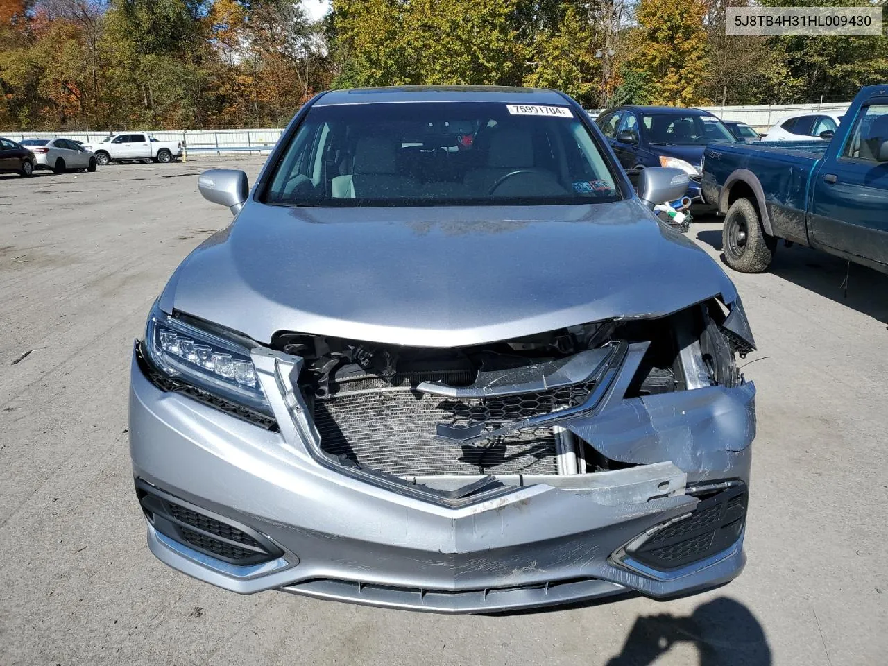 2017 Acura Rdx VIN: 5J8TB4H31HL009430 Lot: 75991704