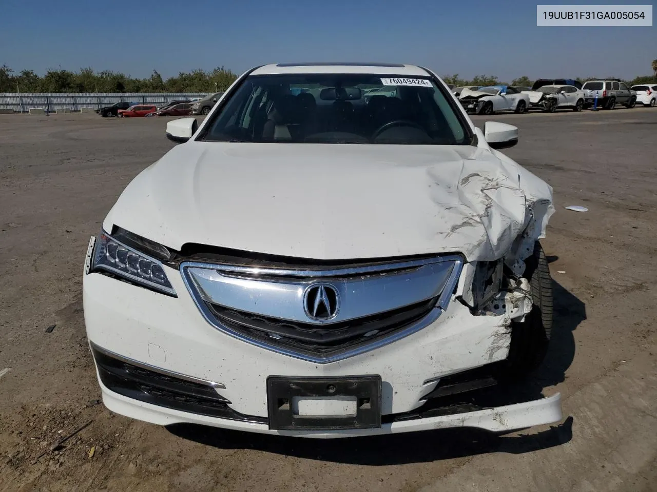 2016 Acura Tlx VIN: 19UUB1F31GA005054 Lot: 76049424