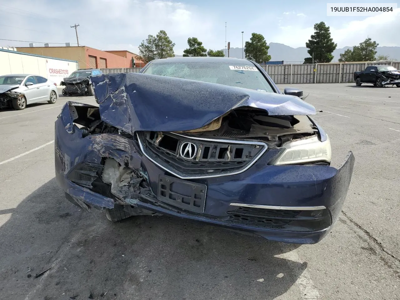 2017 Acura Tlx Tech VIN: 19UUB1F52HA004854 Lot: 76276204