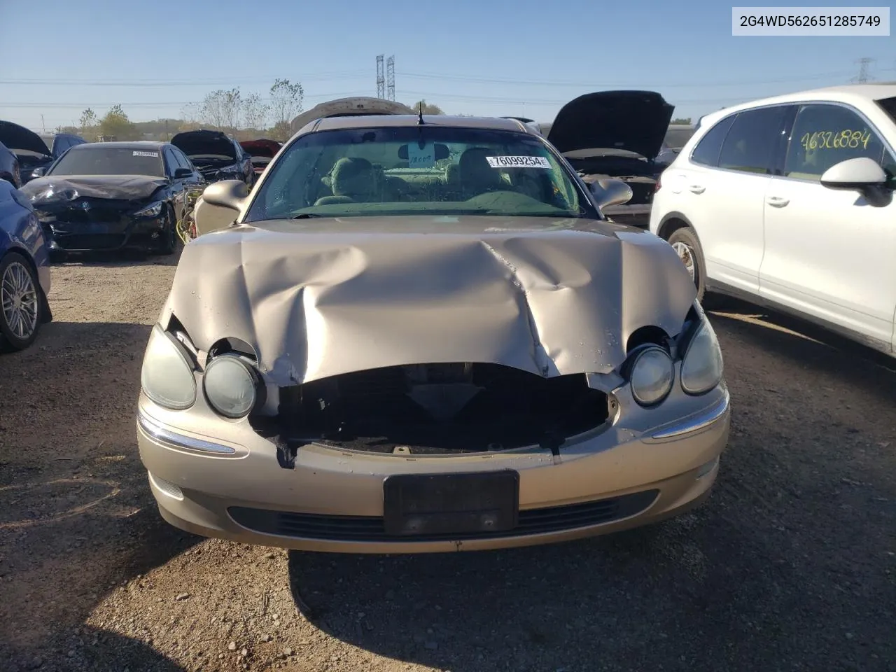 2005 Buick Lacrosse Cxl VIN: 2G4WD562651285749 Lot: 76099254