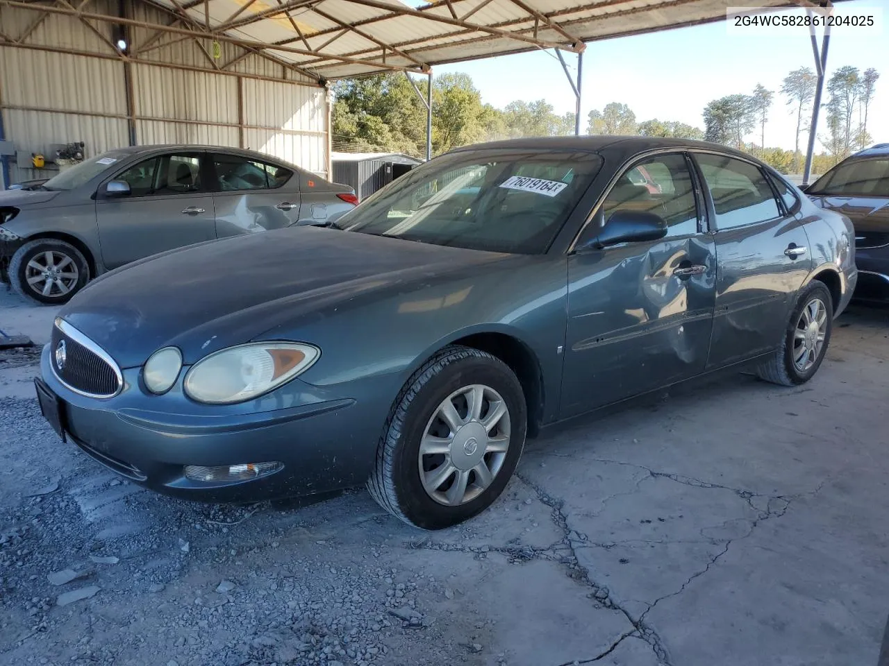 2G4WC582861204025 2006 Buick Lacrosse Cx