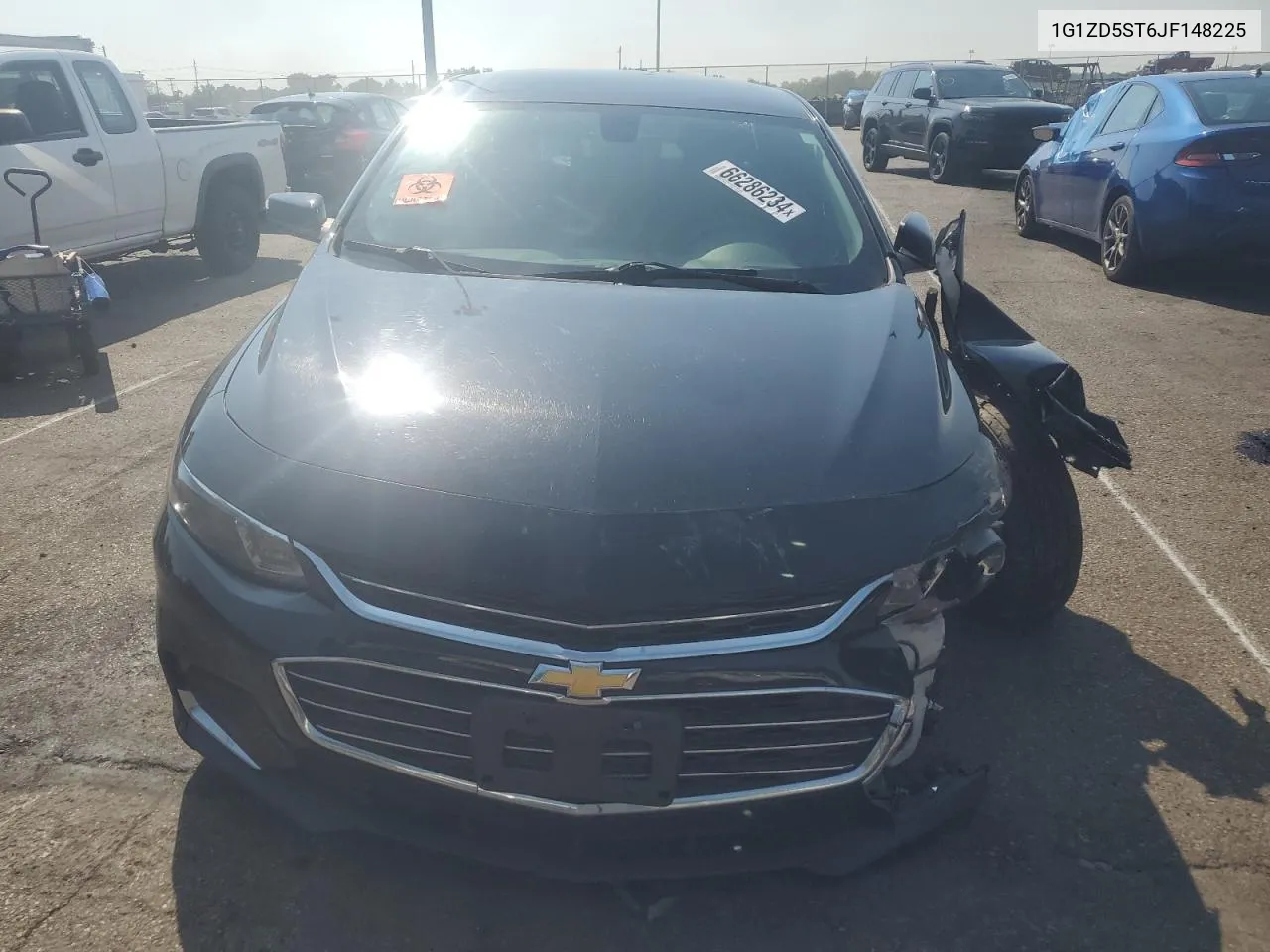 1G1ZD5ST6JF148225 2018 Chevrolet Malibu Lt