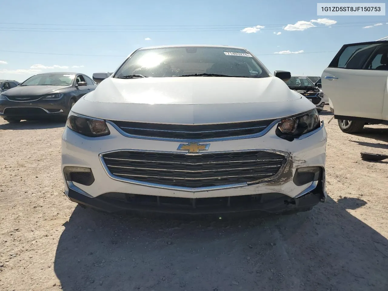 1G1ZD5ST8JF150753 2018 Chevrolet Malibu Lt