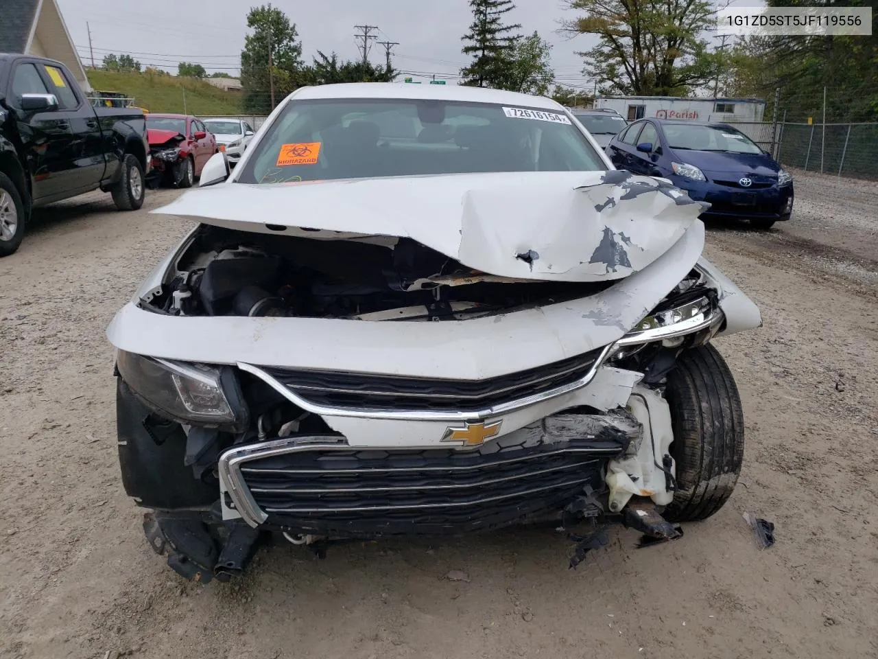 1G1ZD5ST5JF119556 2018 Chevrolet Malibu Lt