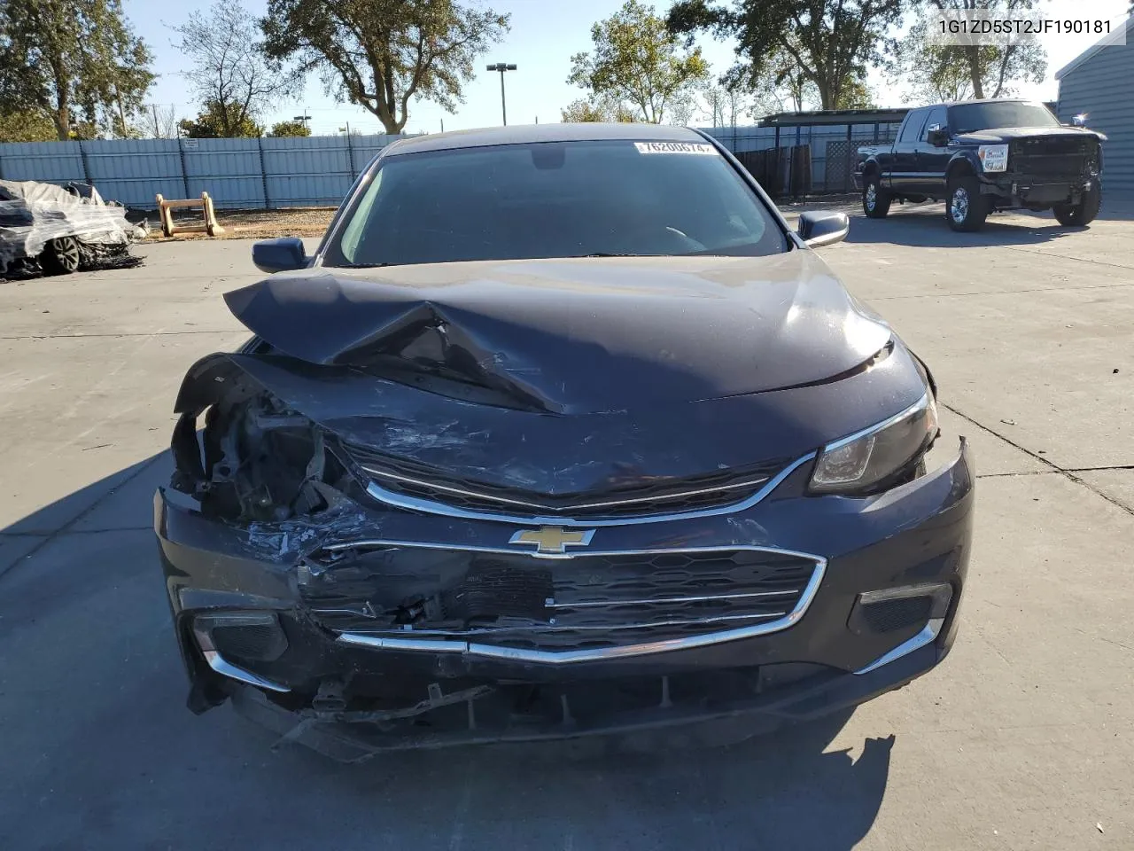 1G1ZD5ST2JF190181 2018 Chevrolet Malibu Lt