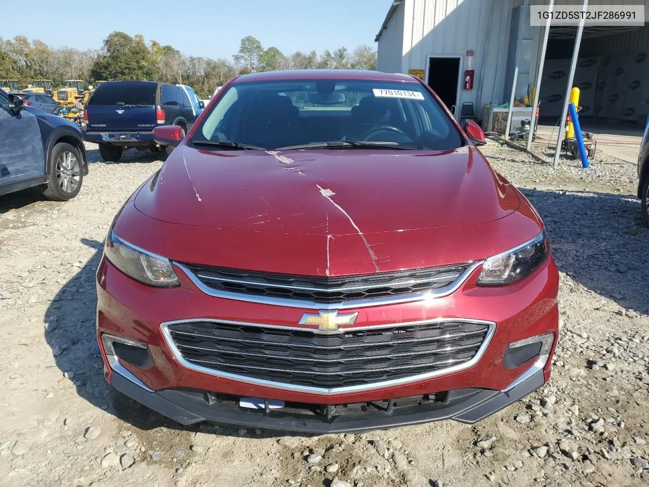 1G1ZD5ST2JF286991 2018 Chevrolet Malibu Lt