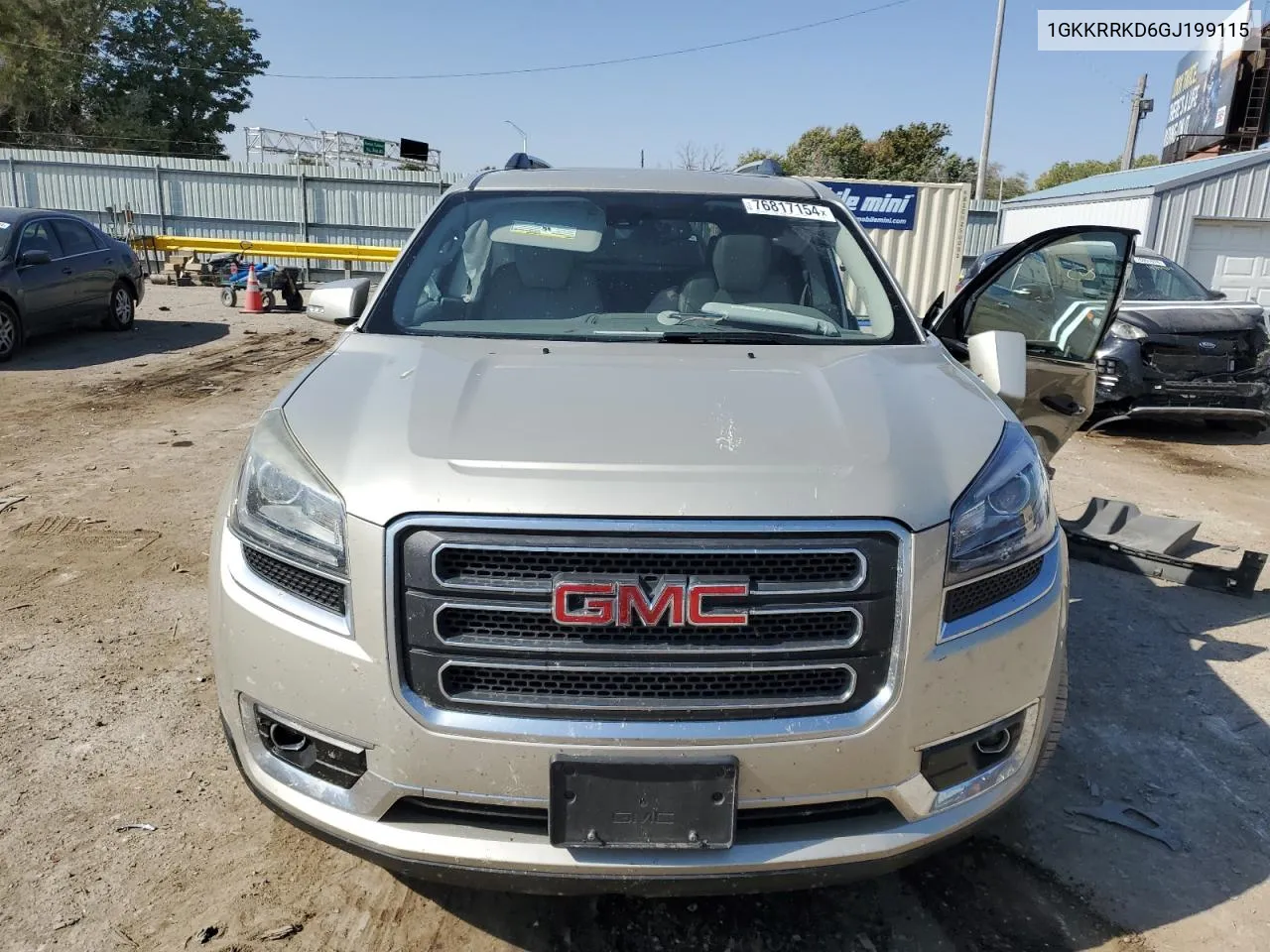 1GKKRRKD6GJ199115 2016 GMC Acadia Slt-1