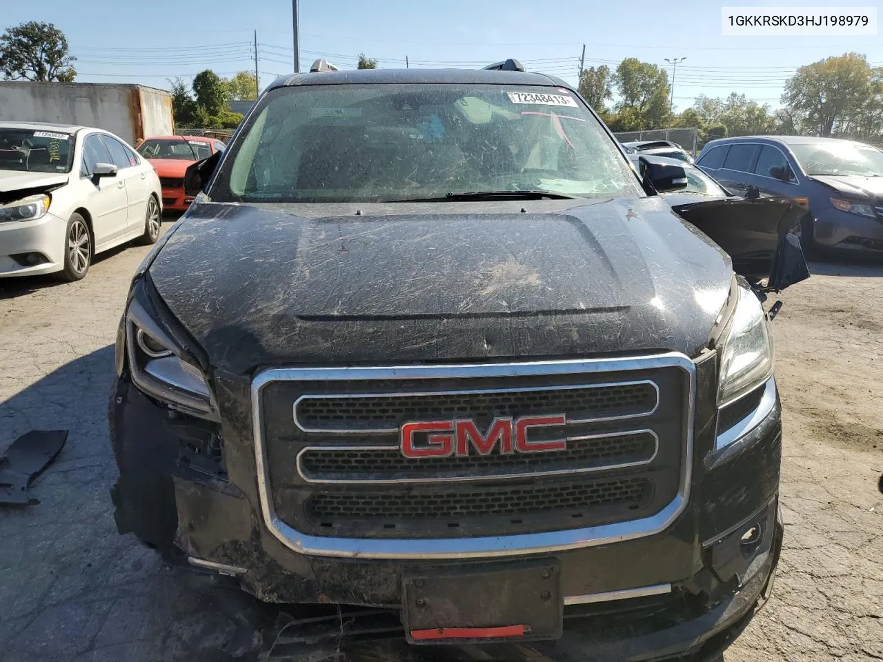 2017 GMC Acadia Limited Slt-2 VIN: 1GKKRSKD3HJ198979 Lot: 72348413