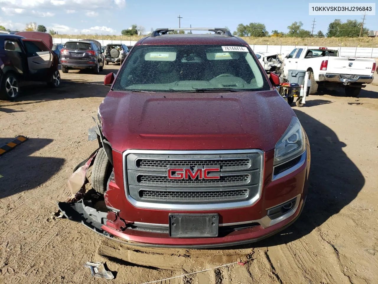 2017 GMC Acadia Limited Slt-2 VIN: 1GKKVSKD3HJ296843 Lot: 76144414