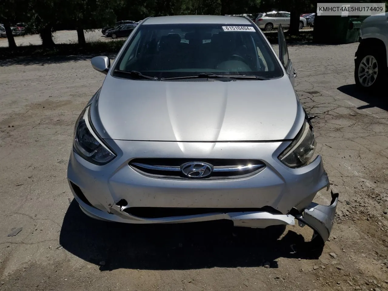 2017 Hyundai Accent Se VIN: KMHCT4AE5HU174409 Lot: 61510404