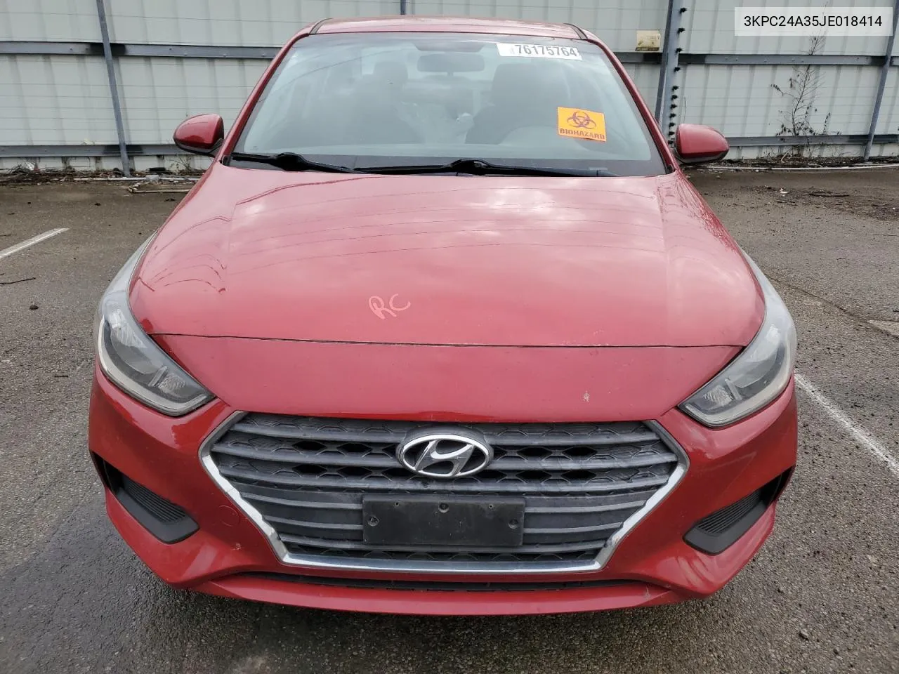 2018 Hyundai Accent Se VIN: 3KPC24A35JE018414 Lot: 76175764