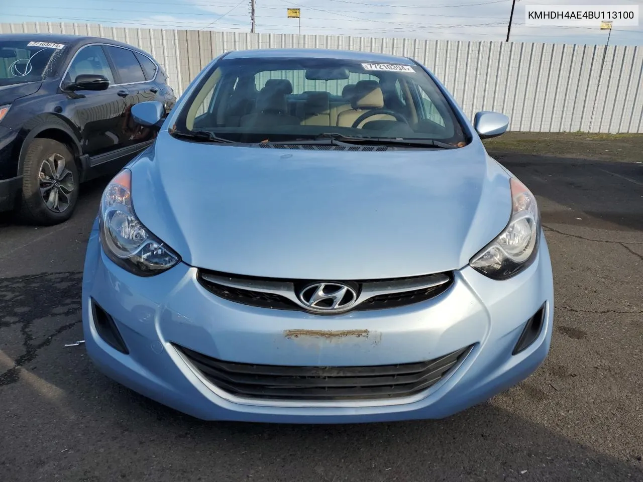 2011 Hyundai Elantra Gls VIN: KMHDH4AE4BU113100 Lot: 77210394