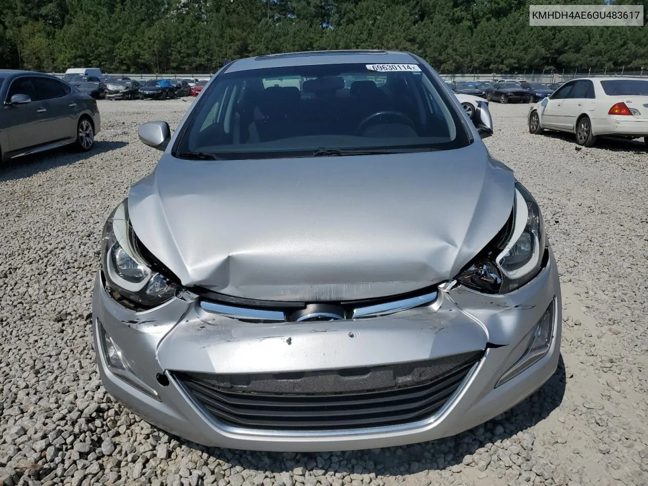 KMHDH4AE6GU483617 2016 Hyundai Elantra Se