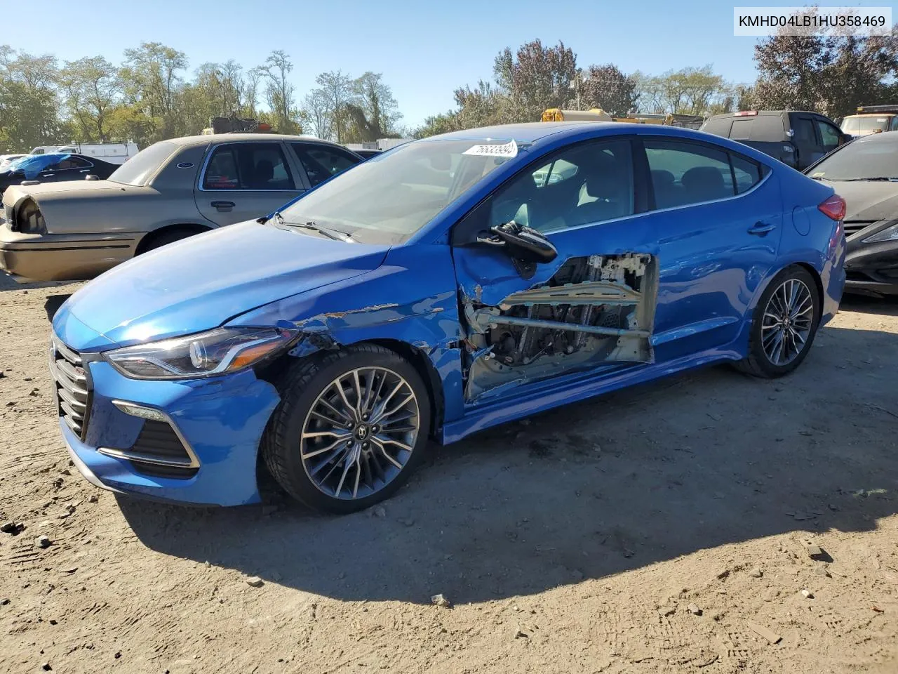 2017 Hyundai Elantra Sport VIN: KMHD04LB1HU358469 Lot: 76633994