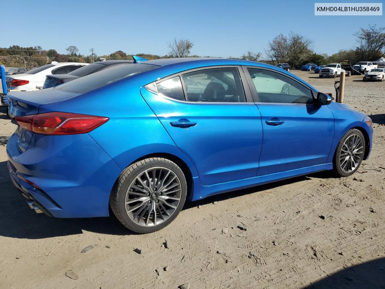 KMHD04LB1HU358469 2017 Hyundai Elantra Sport