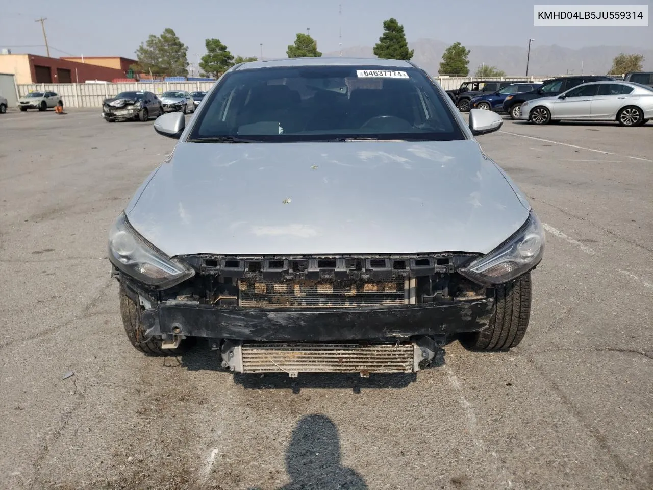 KMHD04LB5JU559314 2018 Hyundai Elantra Sport