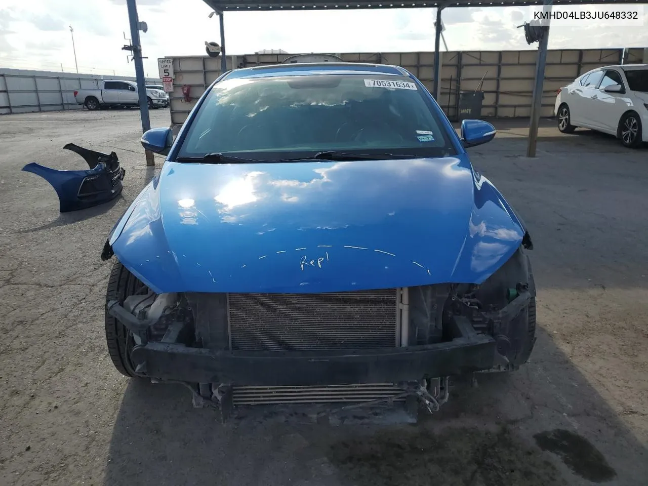 KMHD04LB3JU648332 2018 Hyundai Elantra Sport