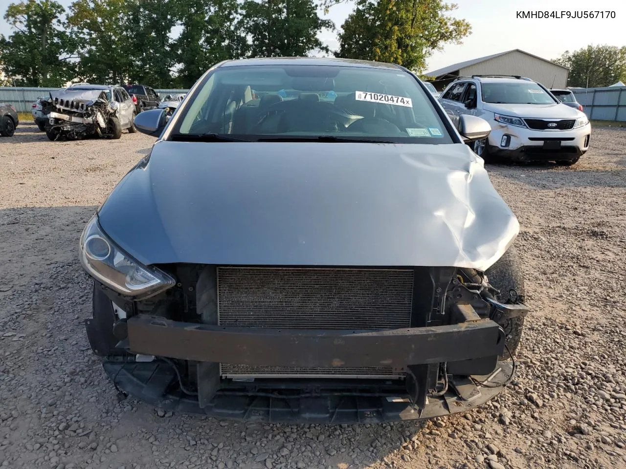 KMHD84LF9JU567170 2018 Hyundai Elantra Sel