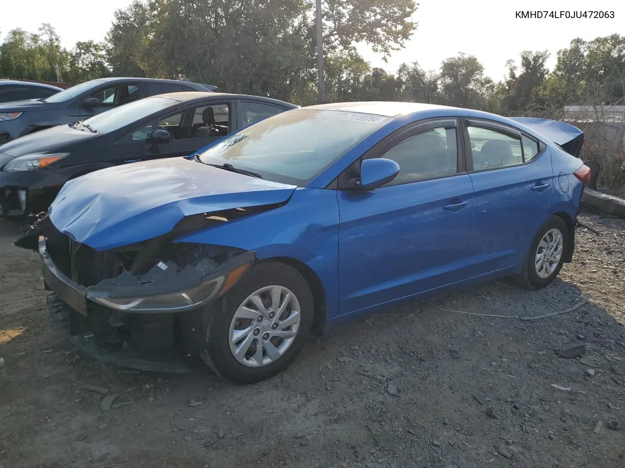 KMHD74LF0JU472063 2018 Hyundai Elantra Se