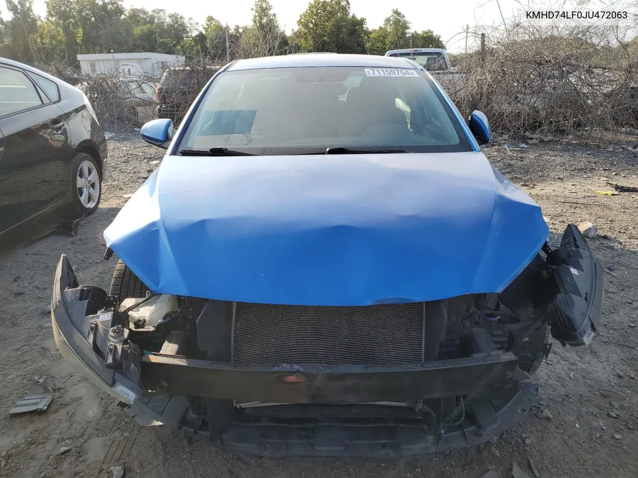 KMHD74LF0JU472063 2018 Hyundai Elantra Se