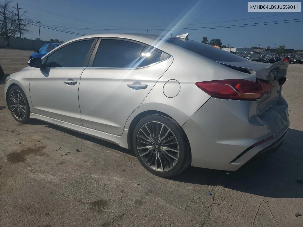 KMHD04LB9JU559011 2018 Hyundai Elantra Sport