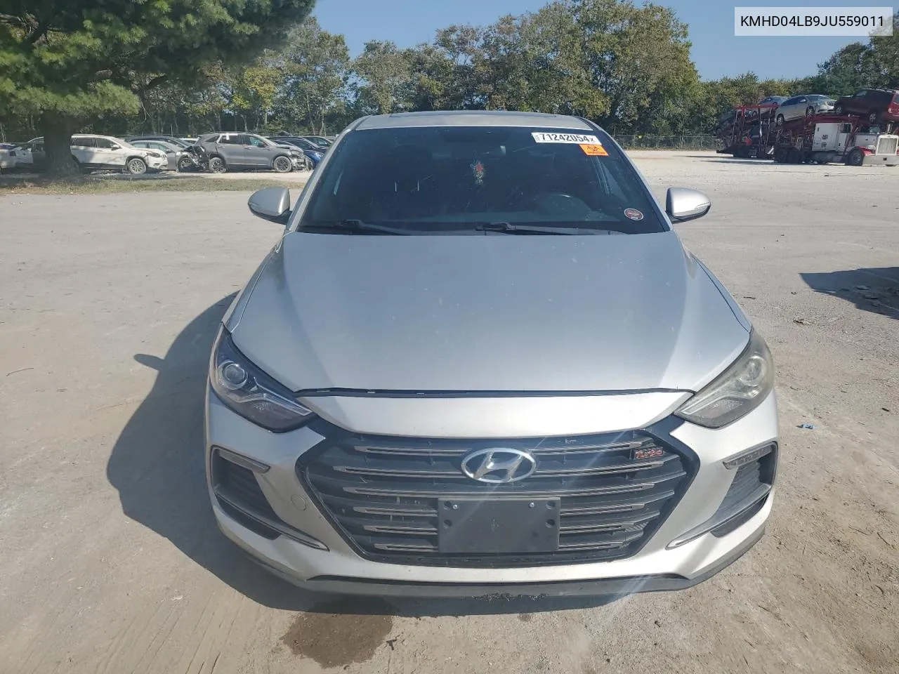 KMHD04LB9JU559011 2018 Hyundai Elantra Sport