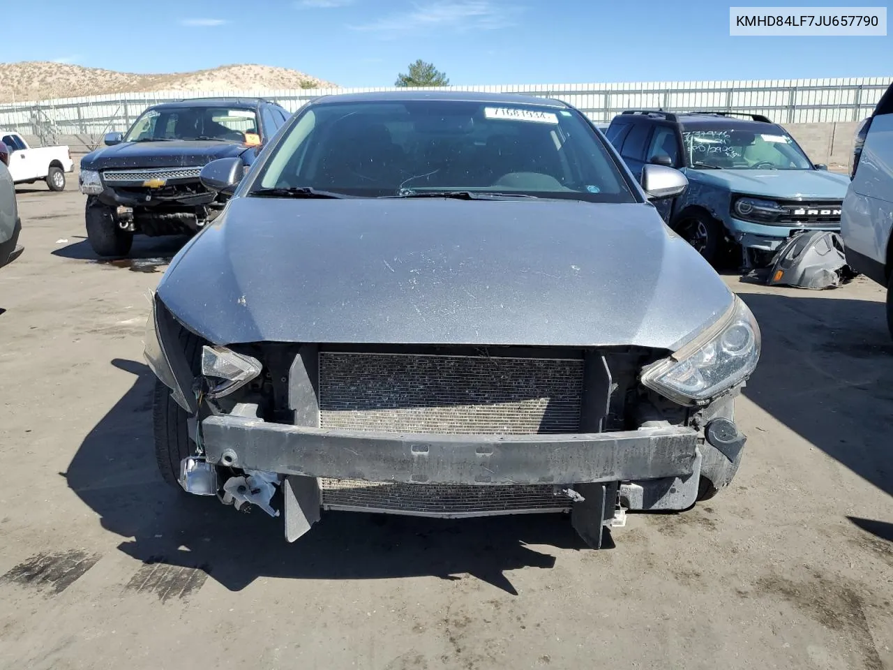 KMHD84LF7JU657790 2018 Hyundai Elantra Sel