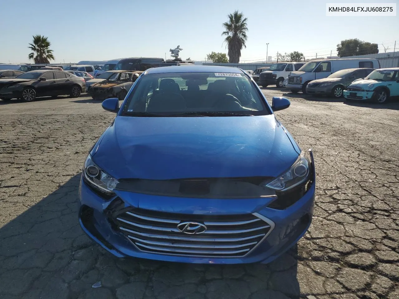 KMHD84LFXJU608275 2018 Hyundai Elantra Sel