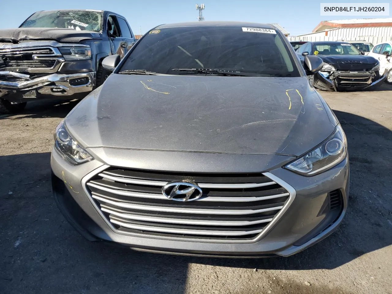 2018 Hyundai Elantra Sel VIN: 5NPD84LF1JH260204 Lot: 72988384