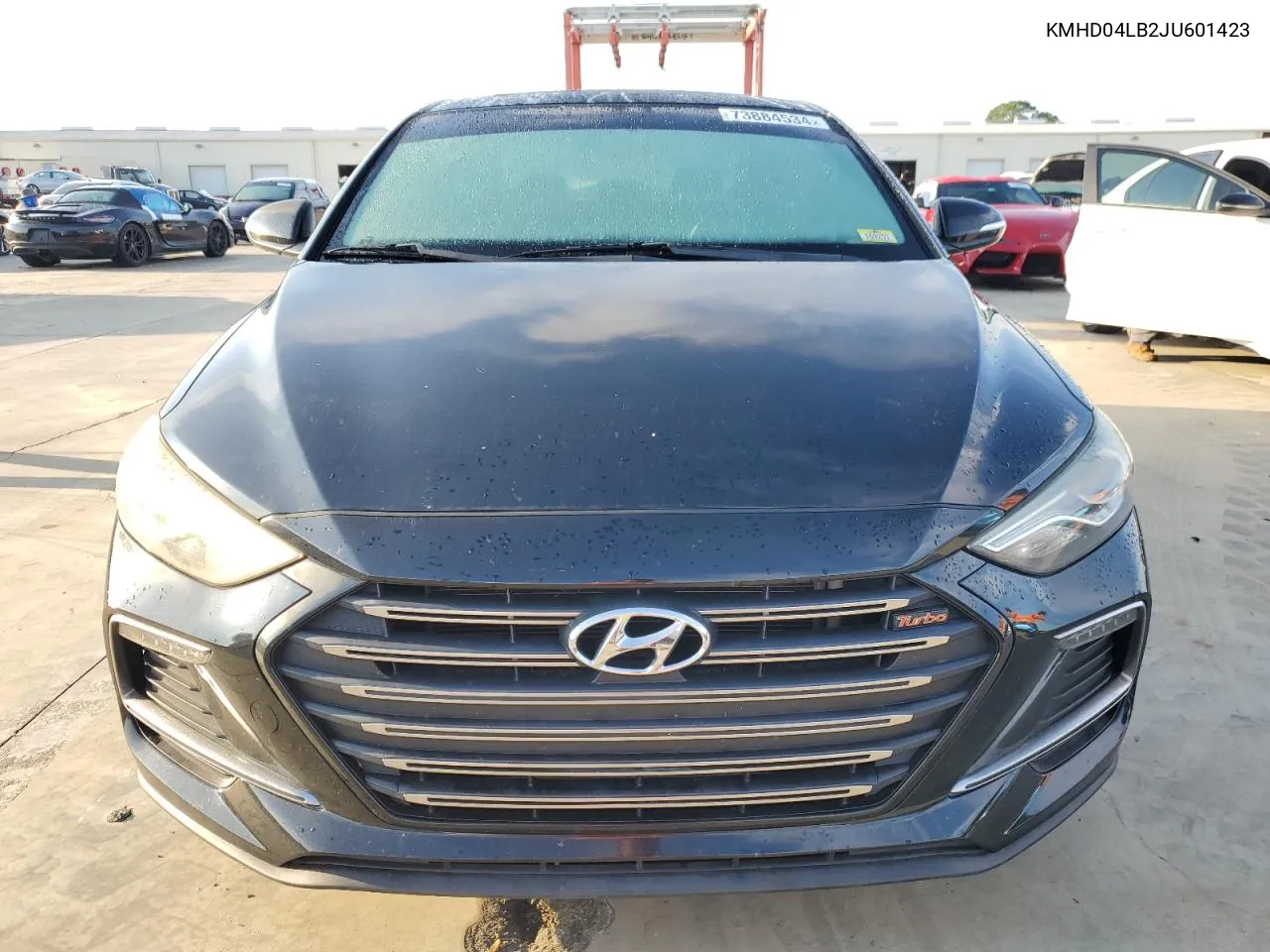 KMHD04LB2JU601423 2018 Hyundai Elantra Sport