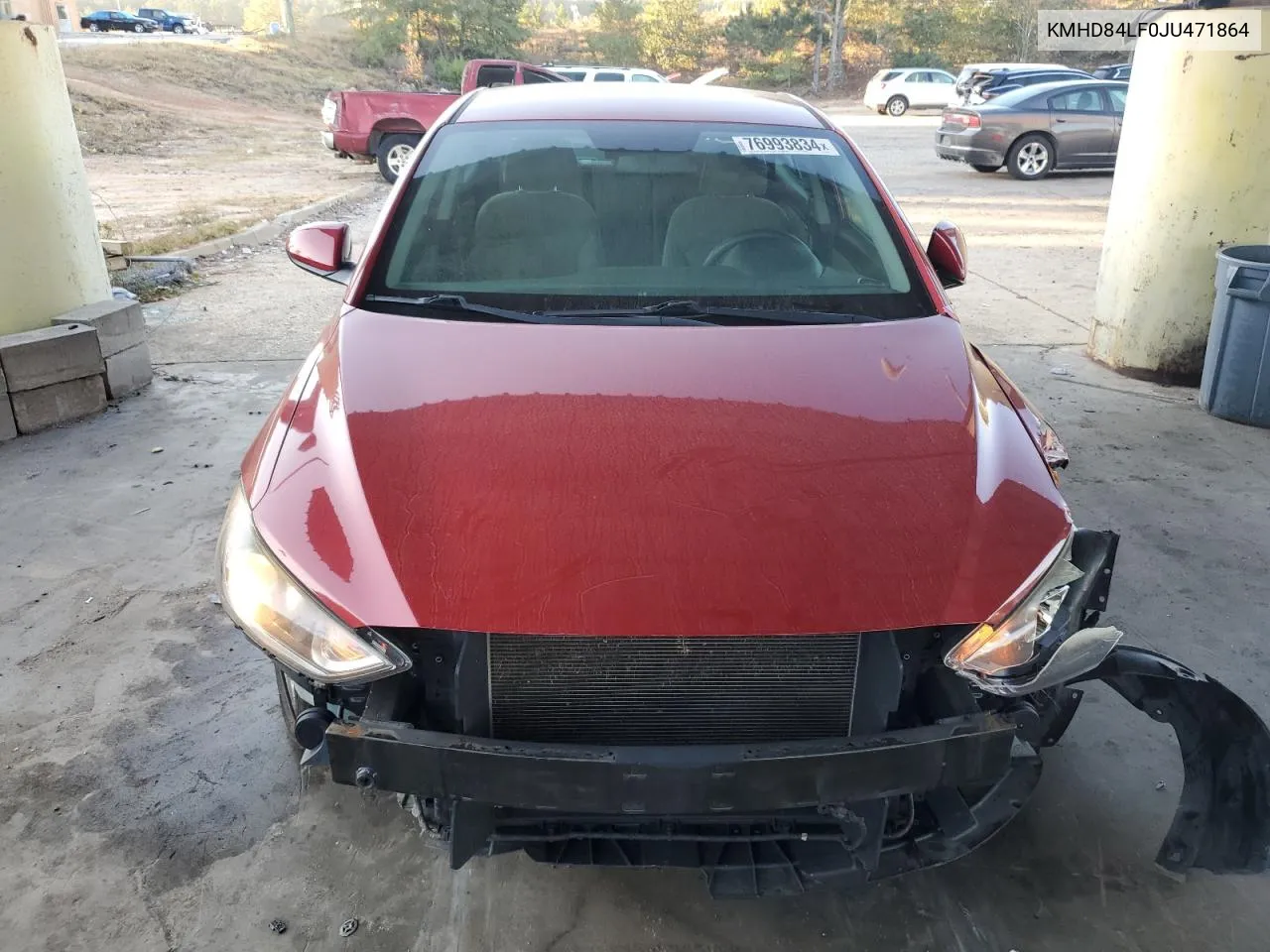 KMHD84LF0JU471864 2018 Hyundai Elantra Sel