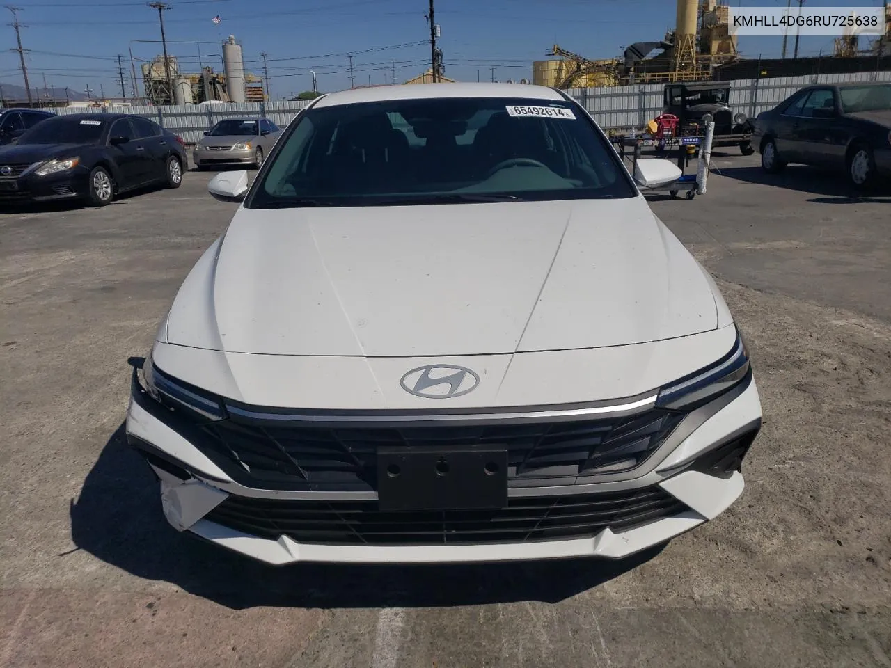 KMHLL4DG6RU725638 2024 Hyundai Elantra Se