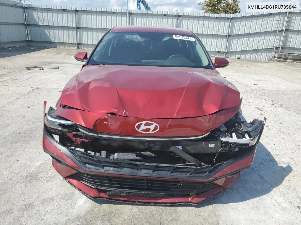 KMHLL4DG1RU785844 2024 Hyundai Elantra Se