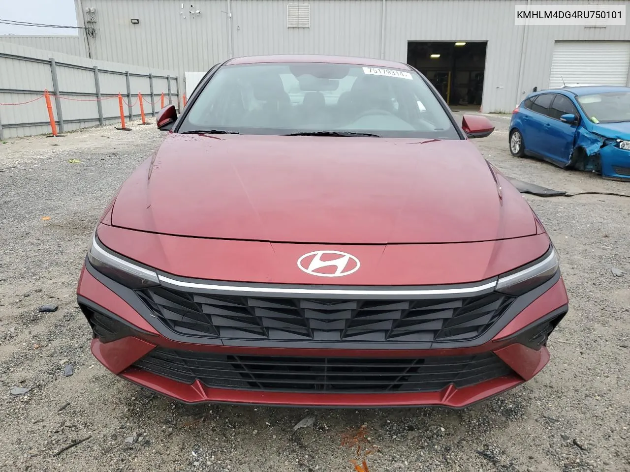 KMHLM4DG4RU750101 2024 Hyundai Elantra Sel