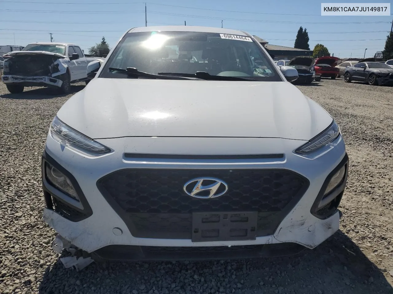 2018 Hyundai Kona Se VIN: KM8K1CAA7JU149817 Lot: 69614464