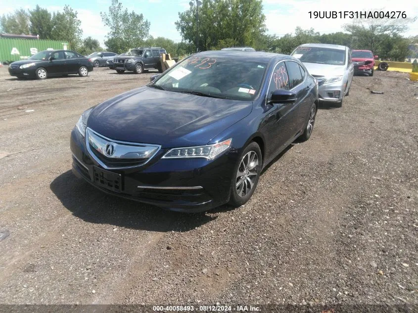 19UUB1F31HA004276 2017 Acura Tlx