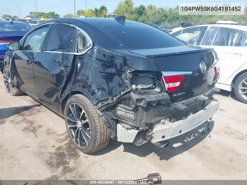 2016 Buick Verano Sport Touring Group VIN: 1G4PW5SK6G4181452 Lot: 40336467