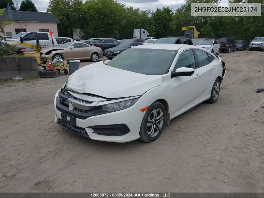 2018 Honda Civic Sedan VIN: 2HGFC2E52JH025174 Lot: 12065972