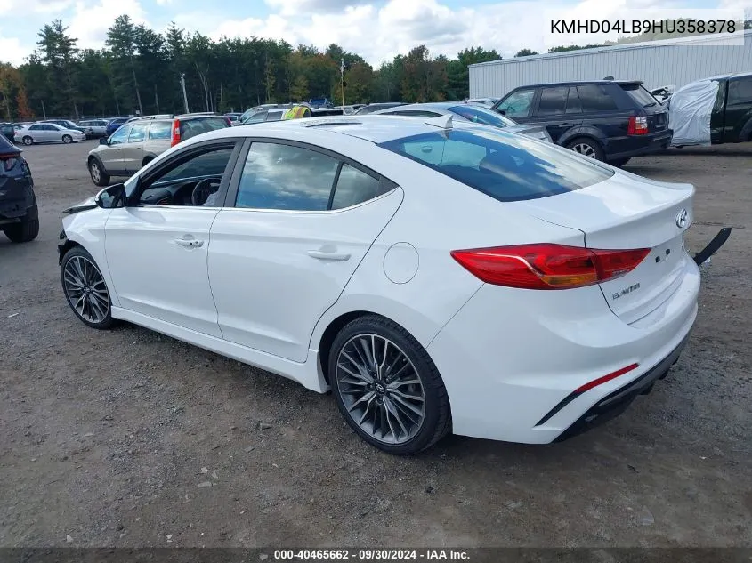 2017 Hyundai Elantra Sport VIN: KMHD04LB9HU358378 Lot: 40465662