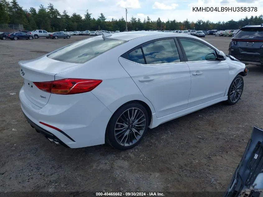 KMHD04LB9HU358378 2017 Hyundai Elantra Sport