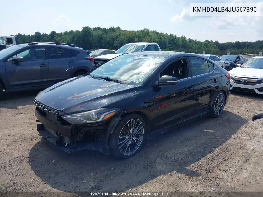 KMHD04LB4JU567890 2018 Hyundai Elantra Sport