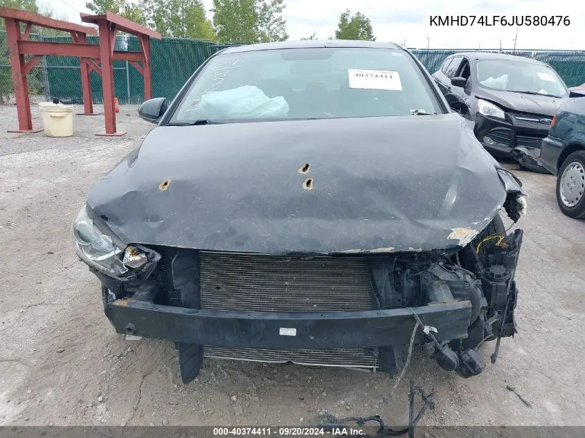 KMHD74LF6JU580476 2018 Hyundai Elantra Se