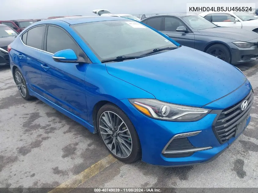 KMHD04LB5JU456524 2018 Hyundai Elantra Sport