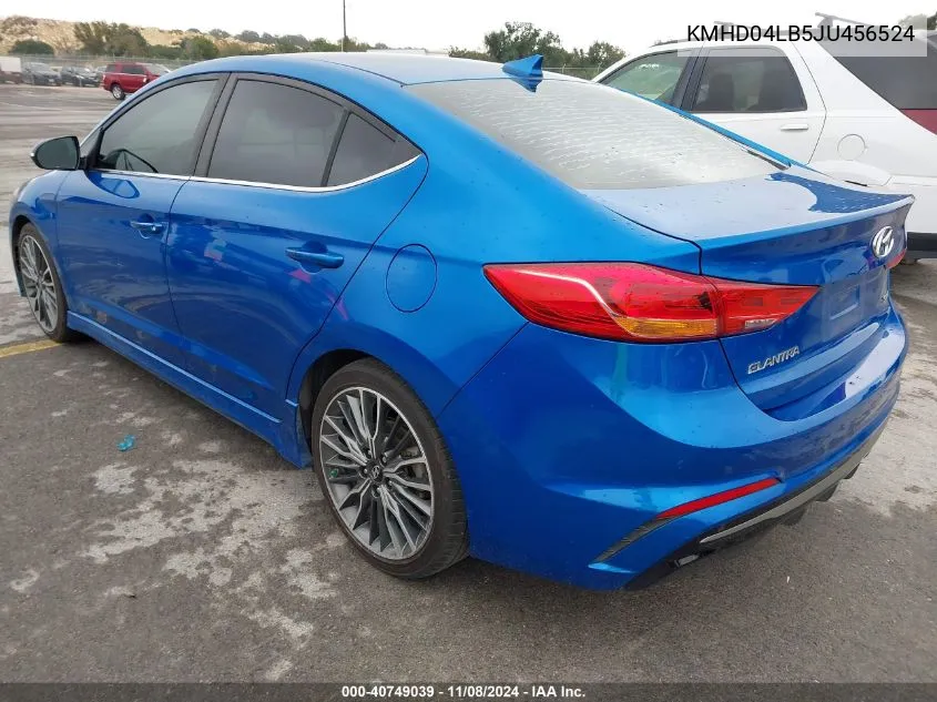 KMHD04LB5JU456524 2018 Hyundai Elantra Sport