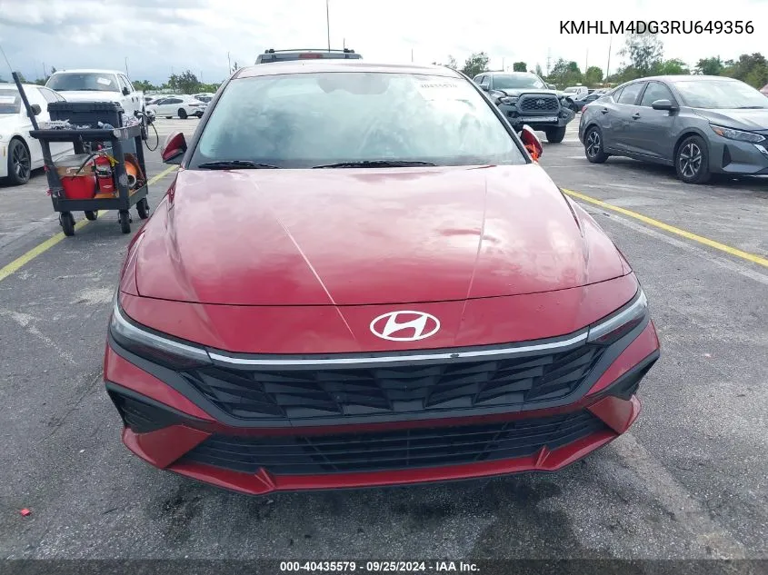 KMHLM4DG3RU649356 2024 Hyundai Elantra Sel